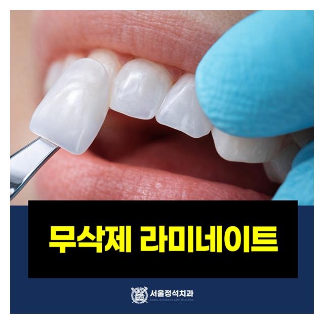 무삭제 라미네이트 더 자연스럽고 아름답게